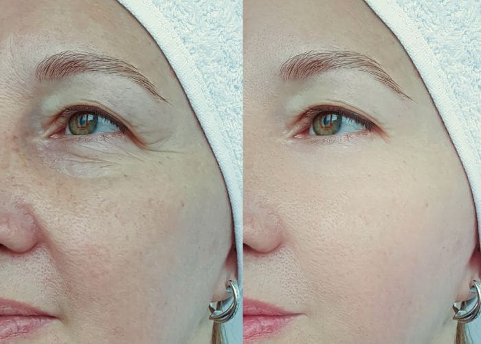 full face (1)